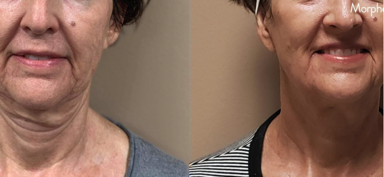 Screenshot 2025-04-30 at 5.00.44 PM